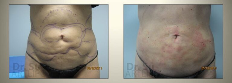 patient photo
