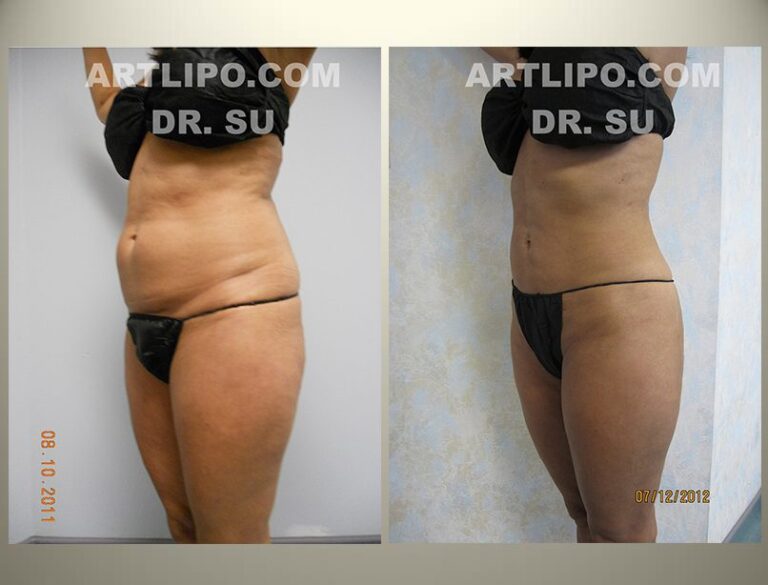 patient photo