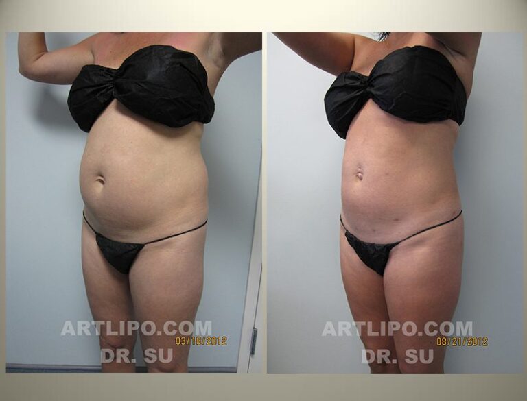 patient photo