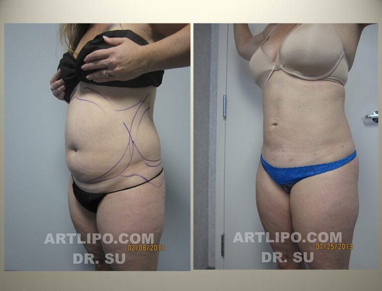 patient photo