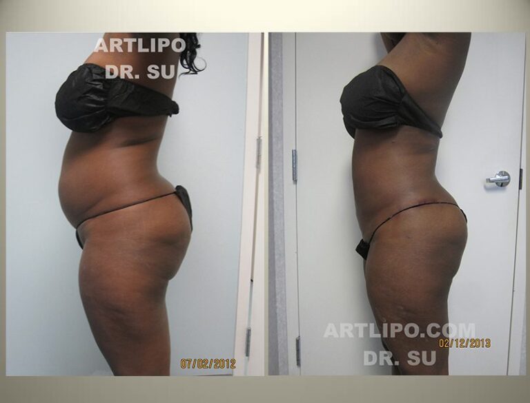 patient photo