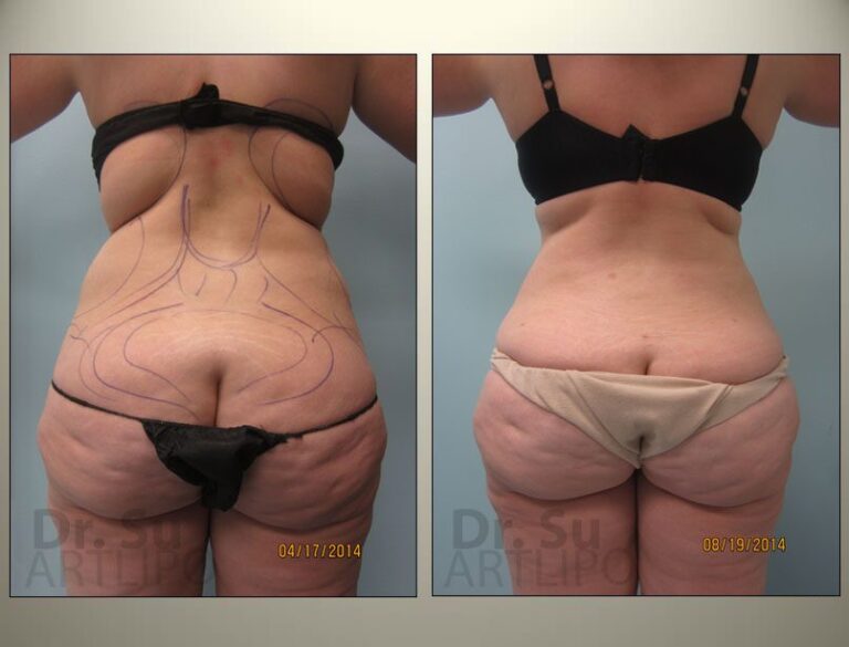 patient photo