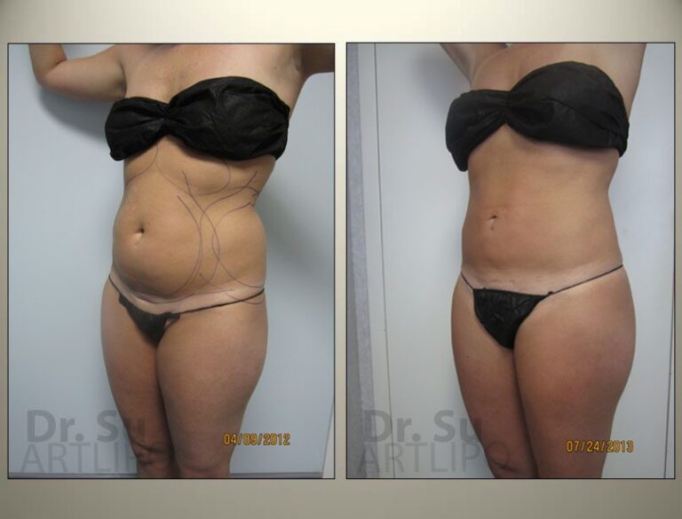 patient photo