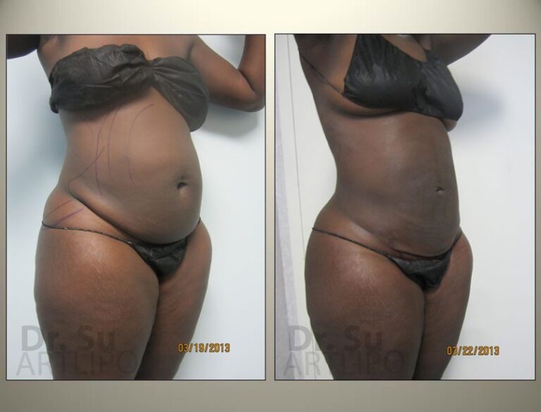 patient photo