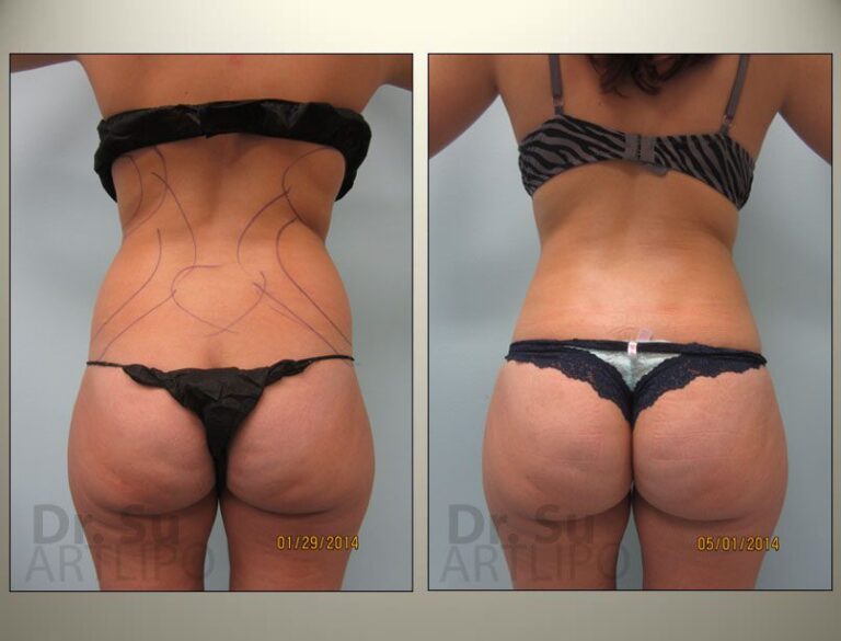patient photo