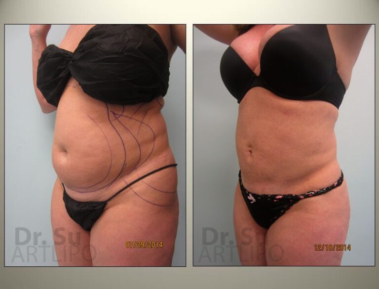 patient photo