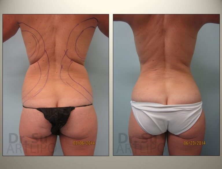 patient photo