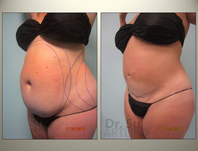 patient photo