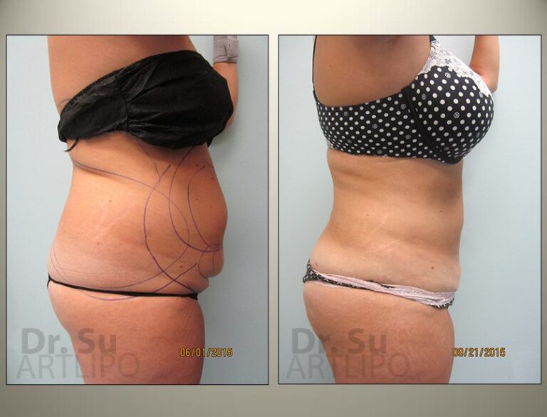 patient photo
