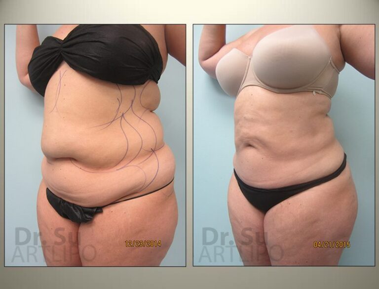 patient photo