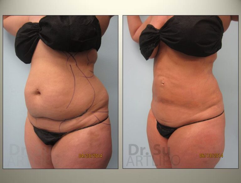 patient photo