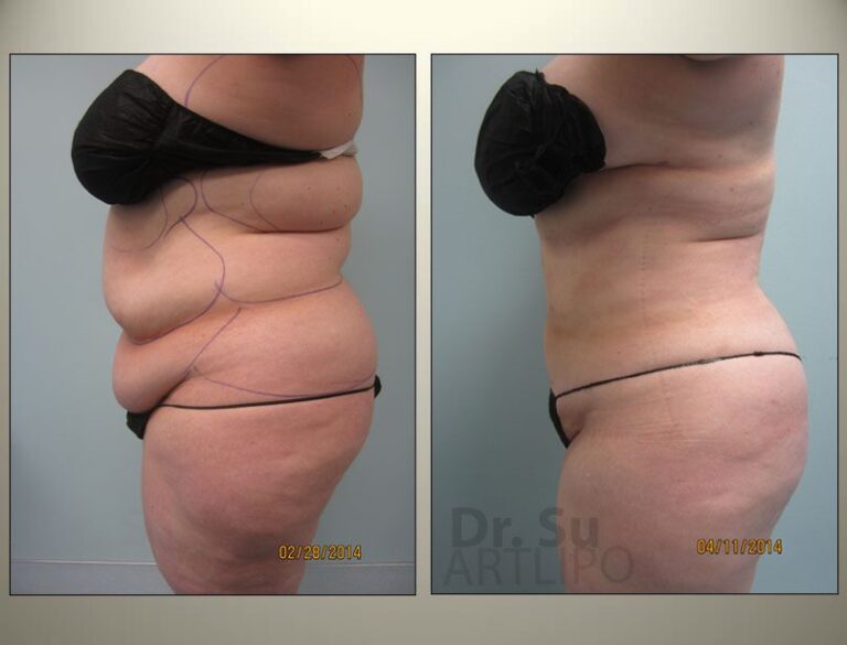 patient photo