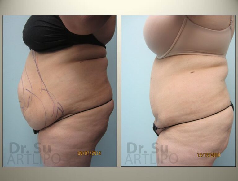 patient photo
