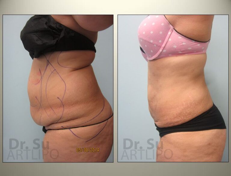 patient photo