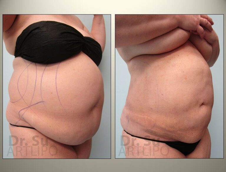 patient photo