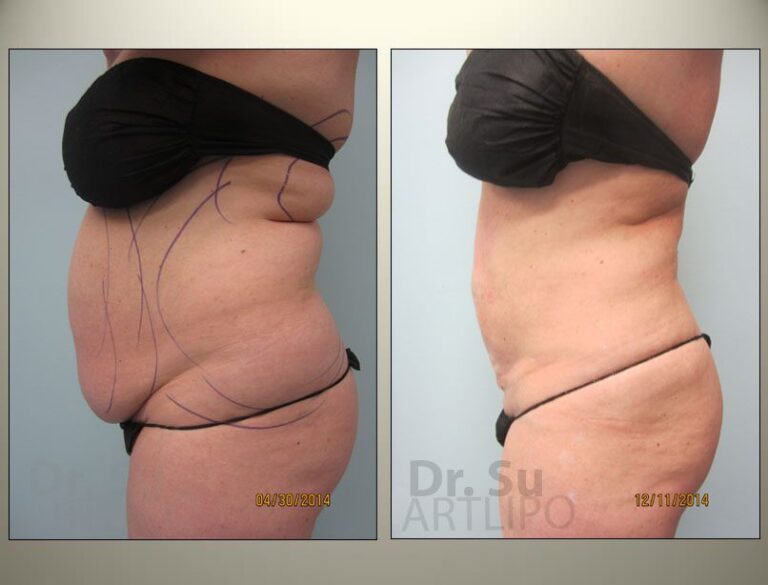 patient photo