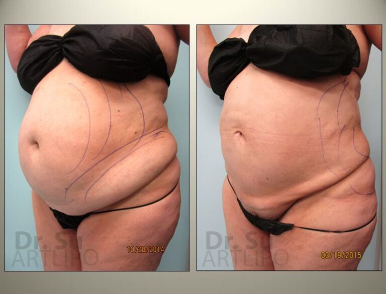patient photo