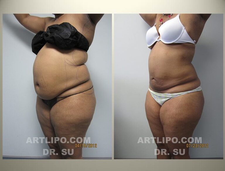 patient photo
