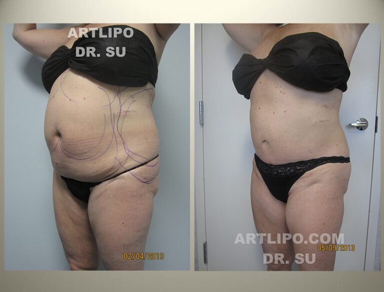 patient photo
