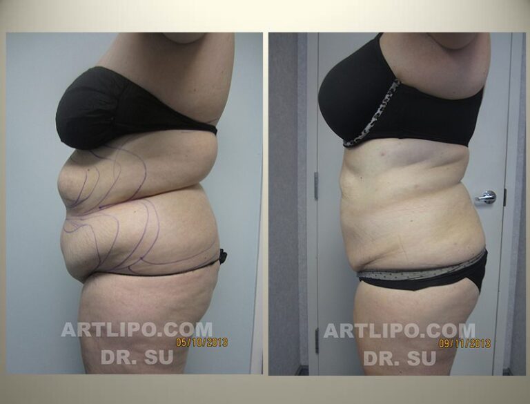 patient photo