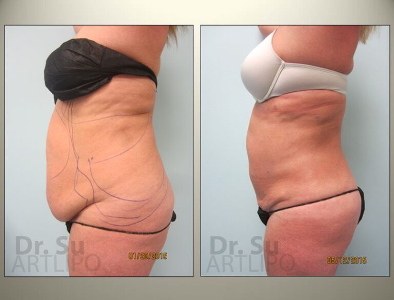 patient photo