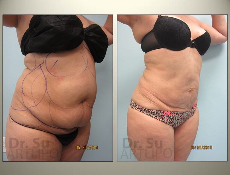 patient photo
