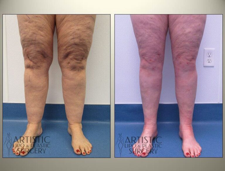 patient photo