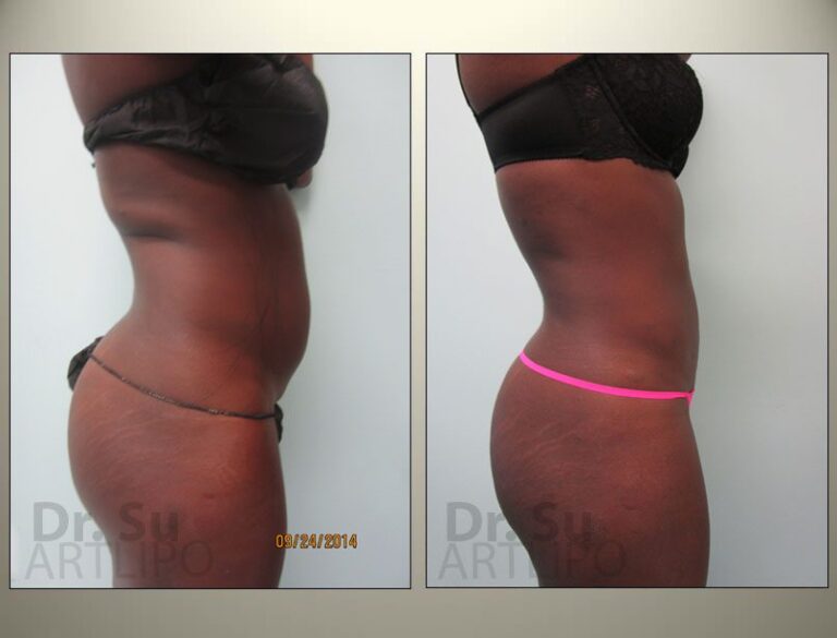 patient photo