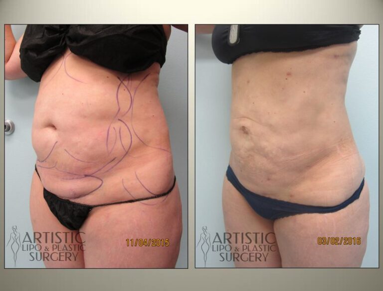 patient photo