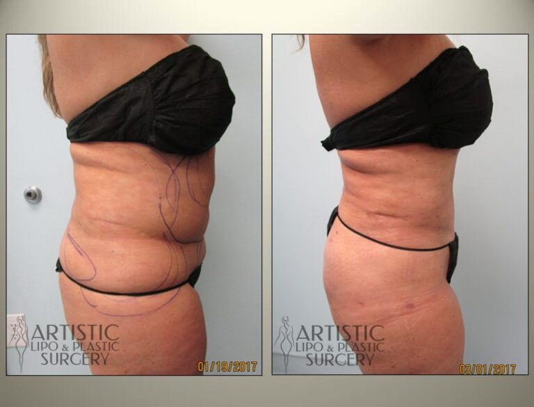 patient photo