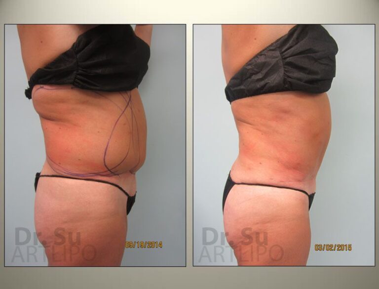 patient photo