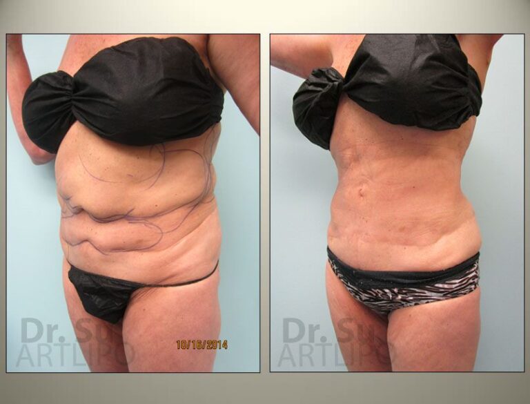 patient photo