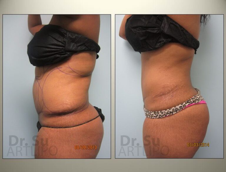 patient photo