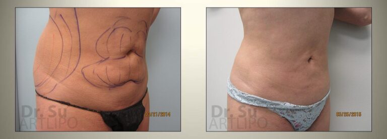 patient photo