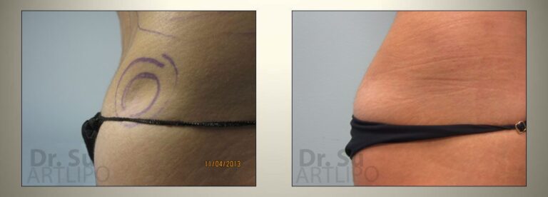 patient photo