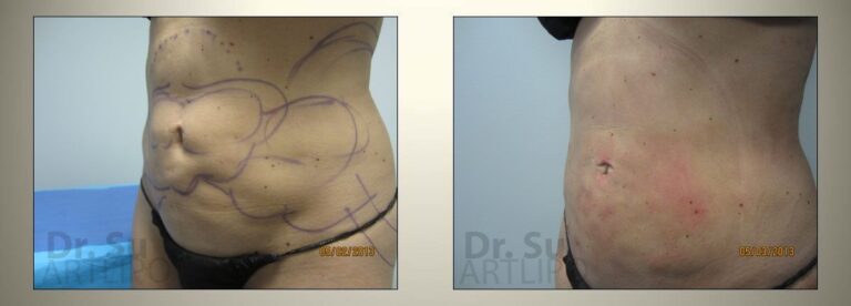 patient photo