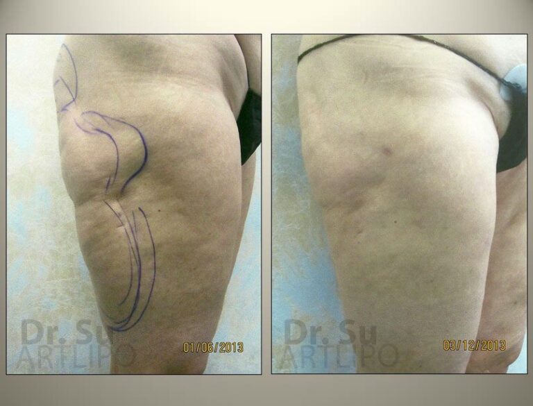 patient photo