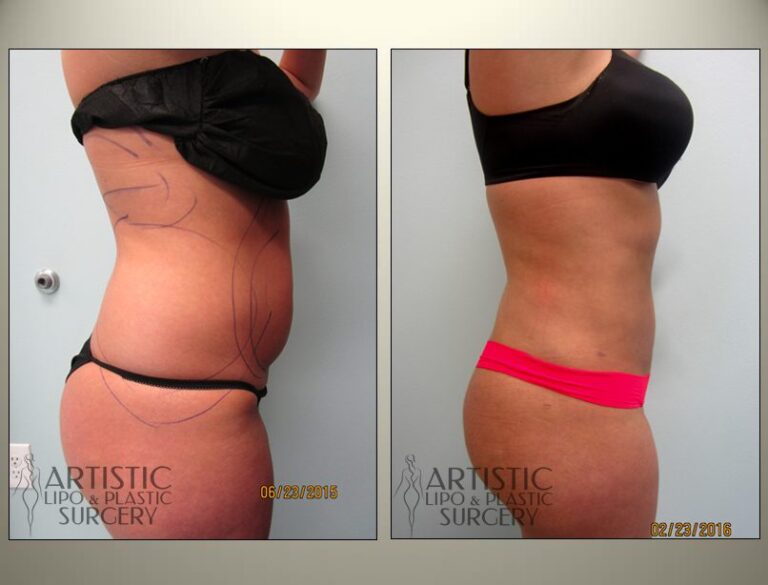patient photo