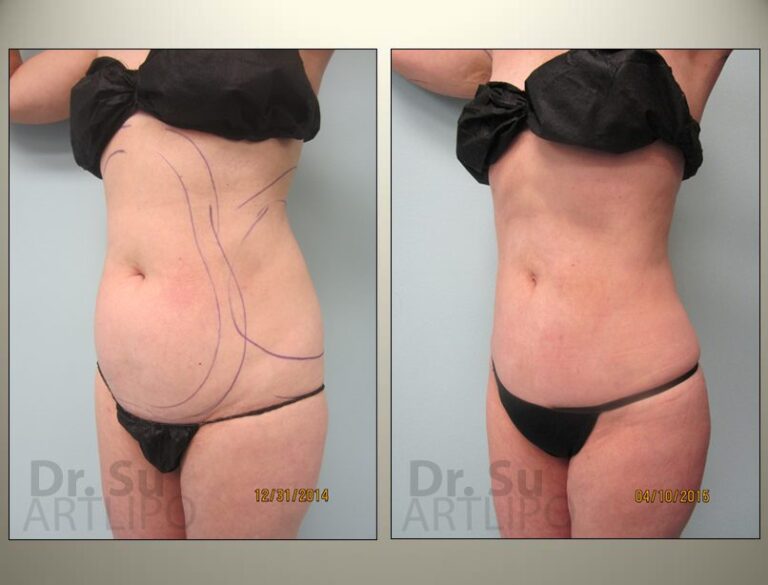 patient photo