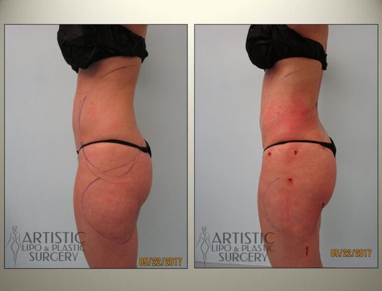 patient photo