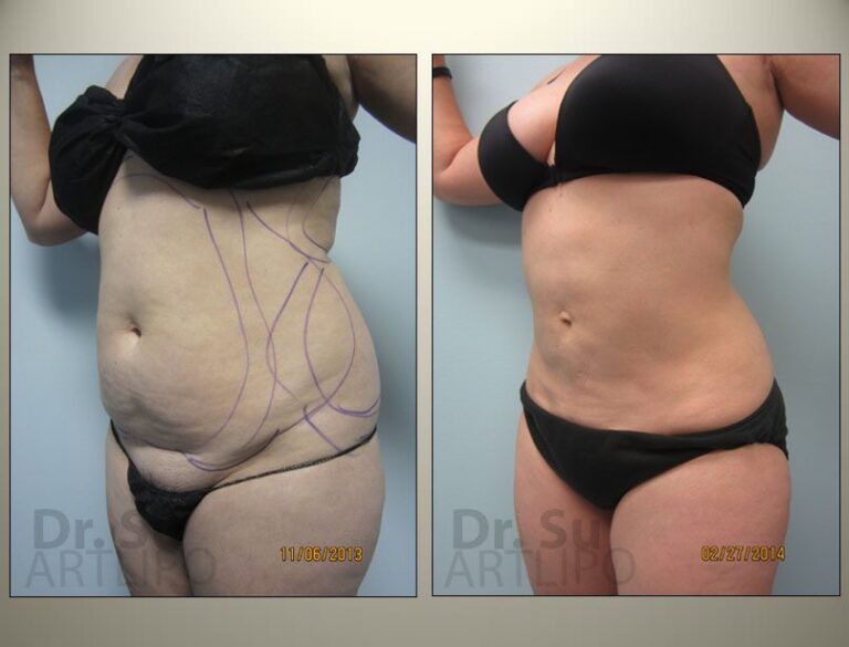 patient photo