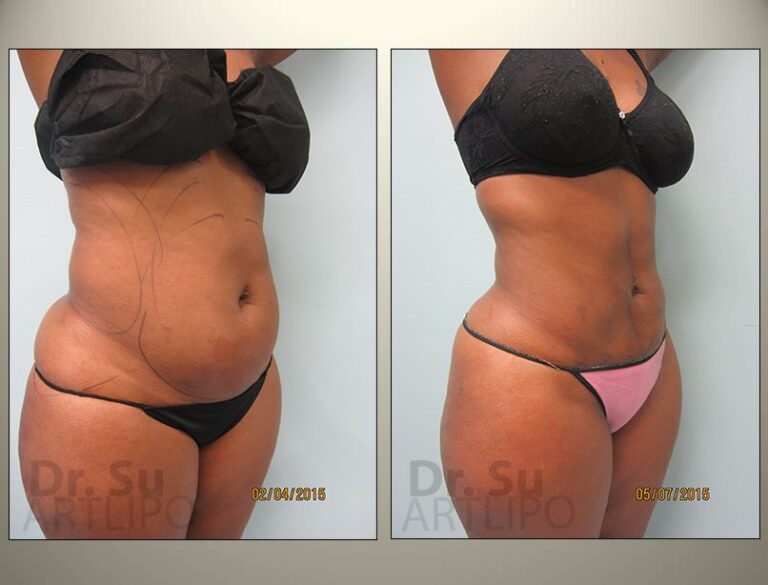 patient photo