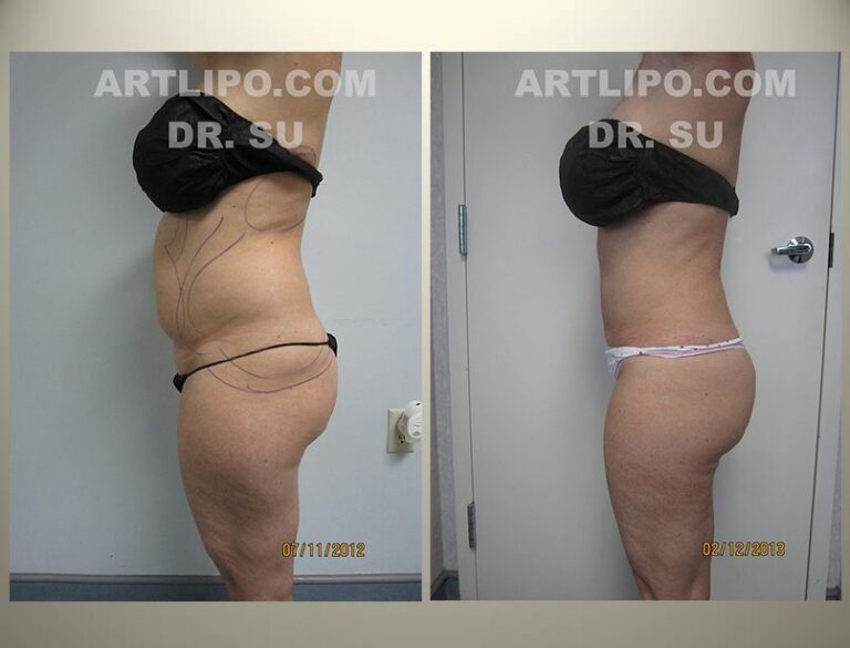 patient photo