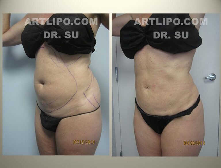 patient photo