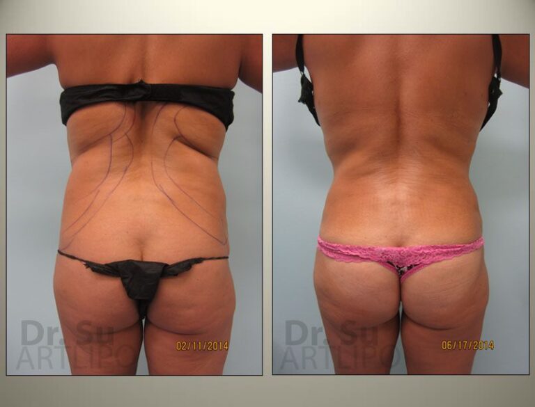 patient photo