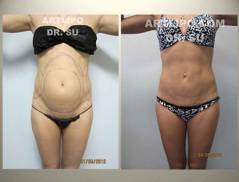 patient photo