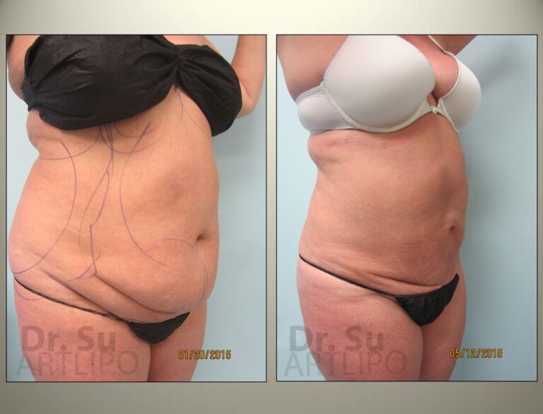 patient photo