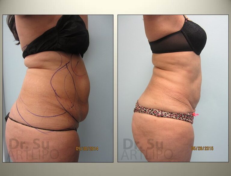 patient photo