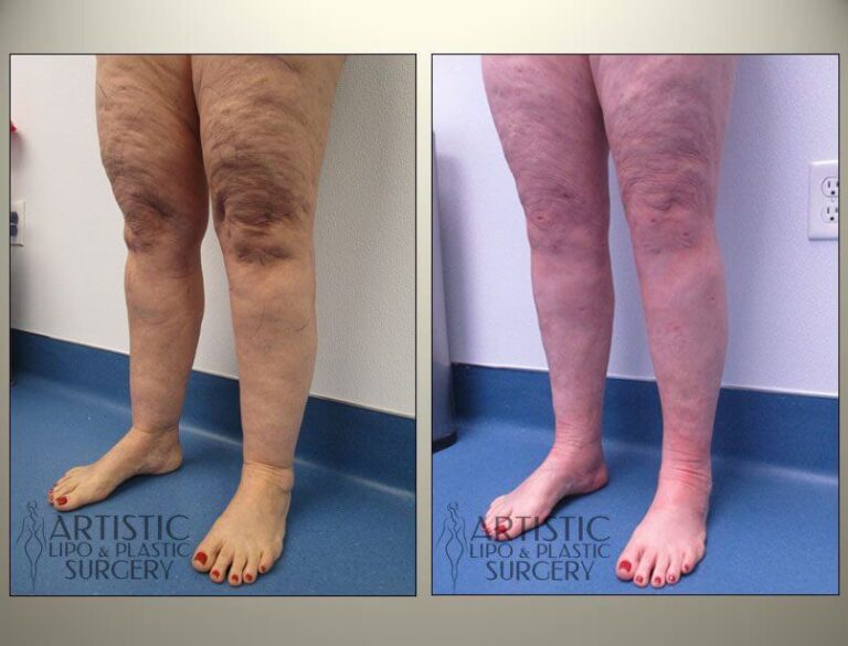 patient photo