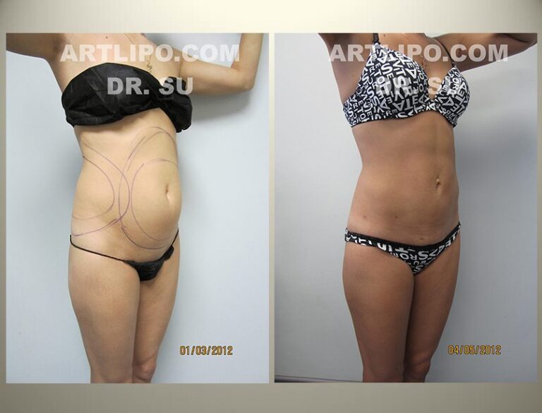 patient photo